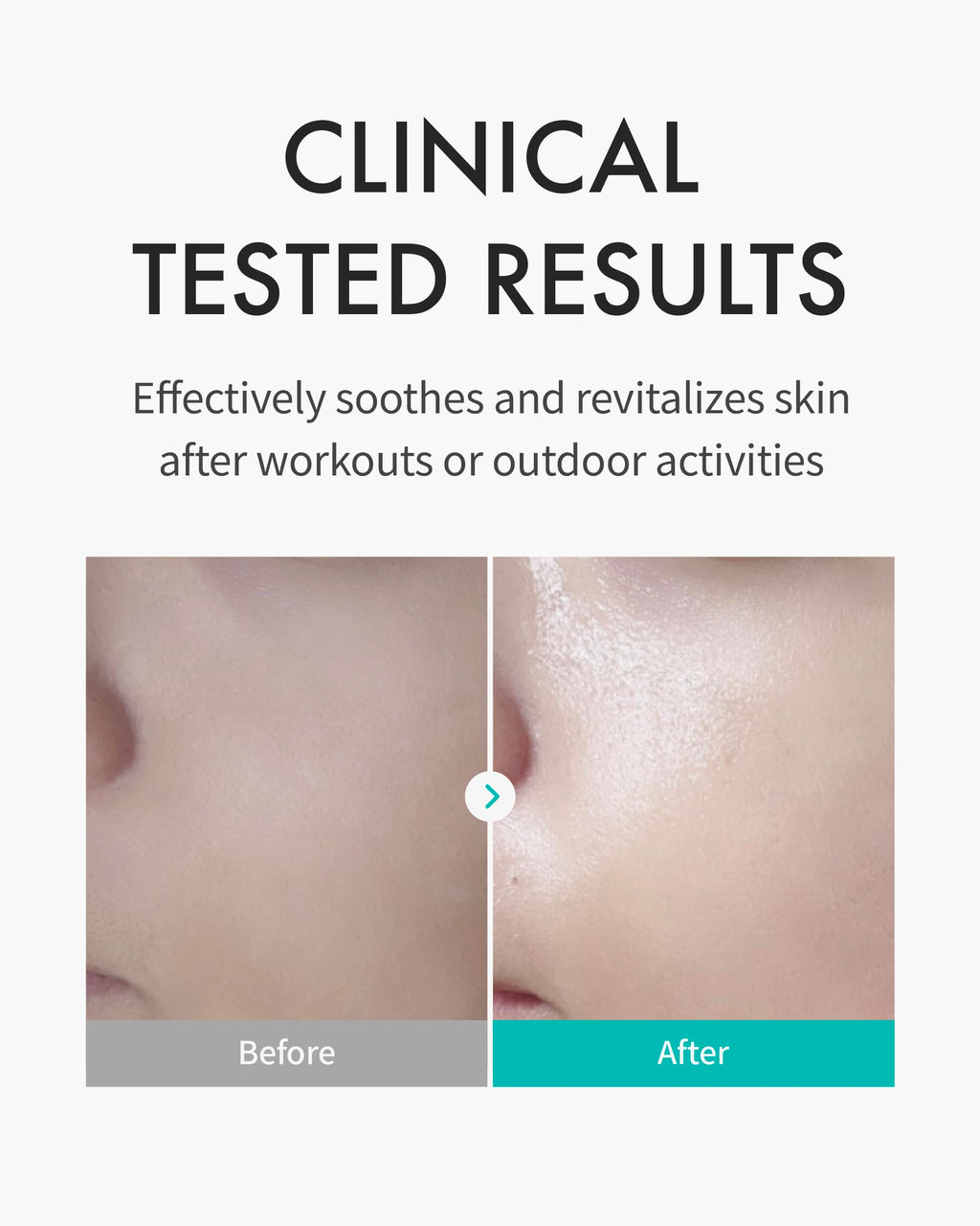 REJURAN® Turnover Mask, c-PDRN® (5ea) – Original Salmon DNA for Firming, Hydration, Repairing & Revitalizing. Achieve Youthful, Radiant Skin. Korean Skincare. Ultra Microfiber Sheet Mask