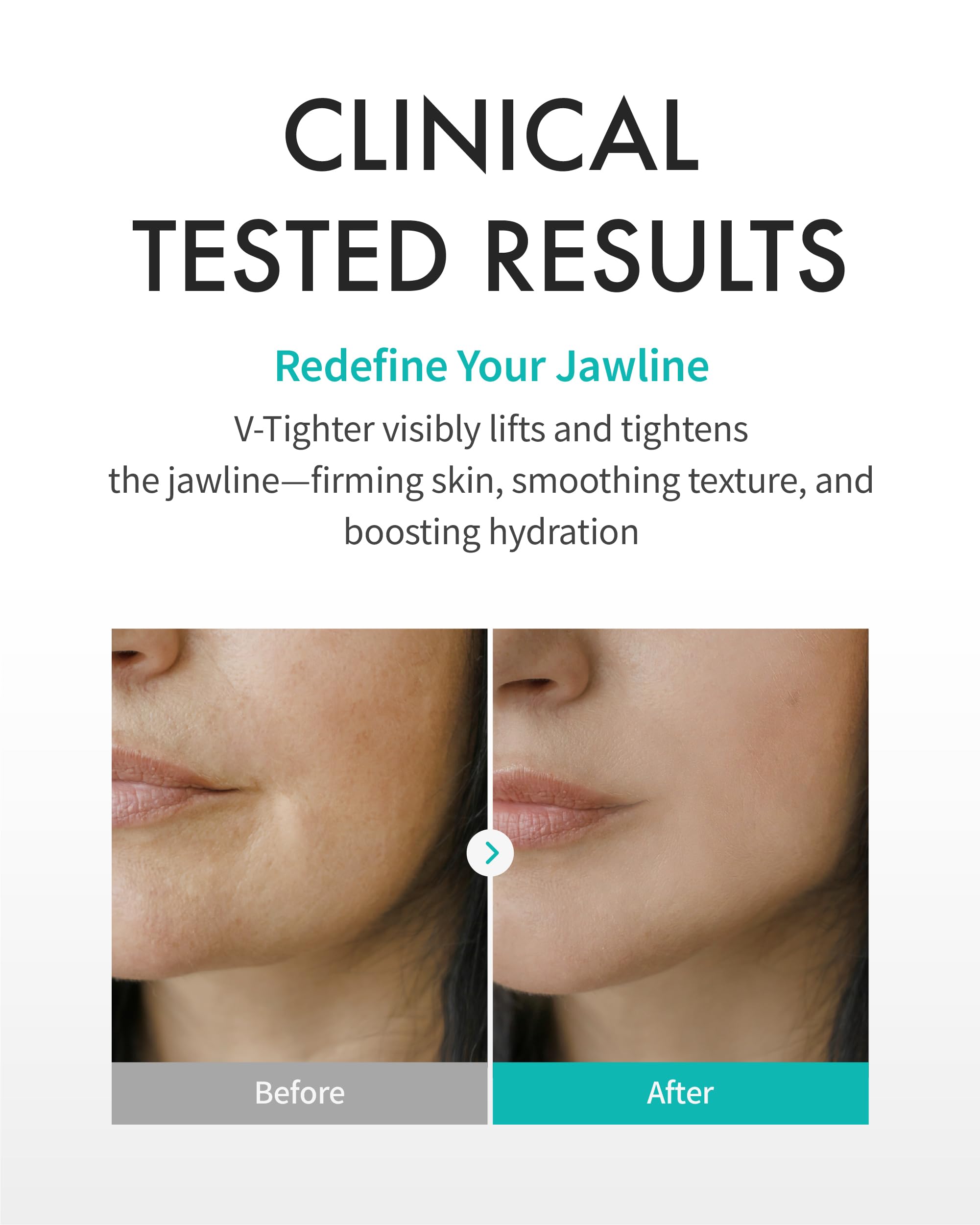 REJURAN® Turnover Mask, c-PDRN® (5ea) – Original Salmon DNA for Firming, Hydration, Repairing & Revitalizing. Achieve Youthful, Radiant Skin. Korean Skincare. Ultra Microfiber Sheet Mask