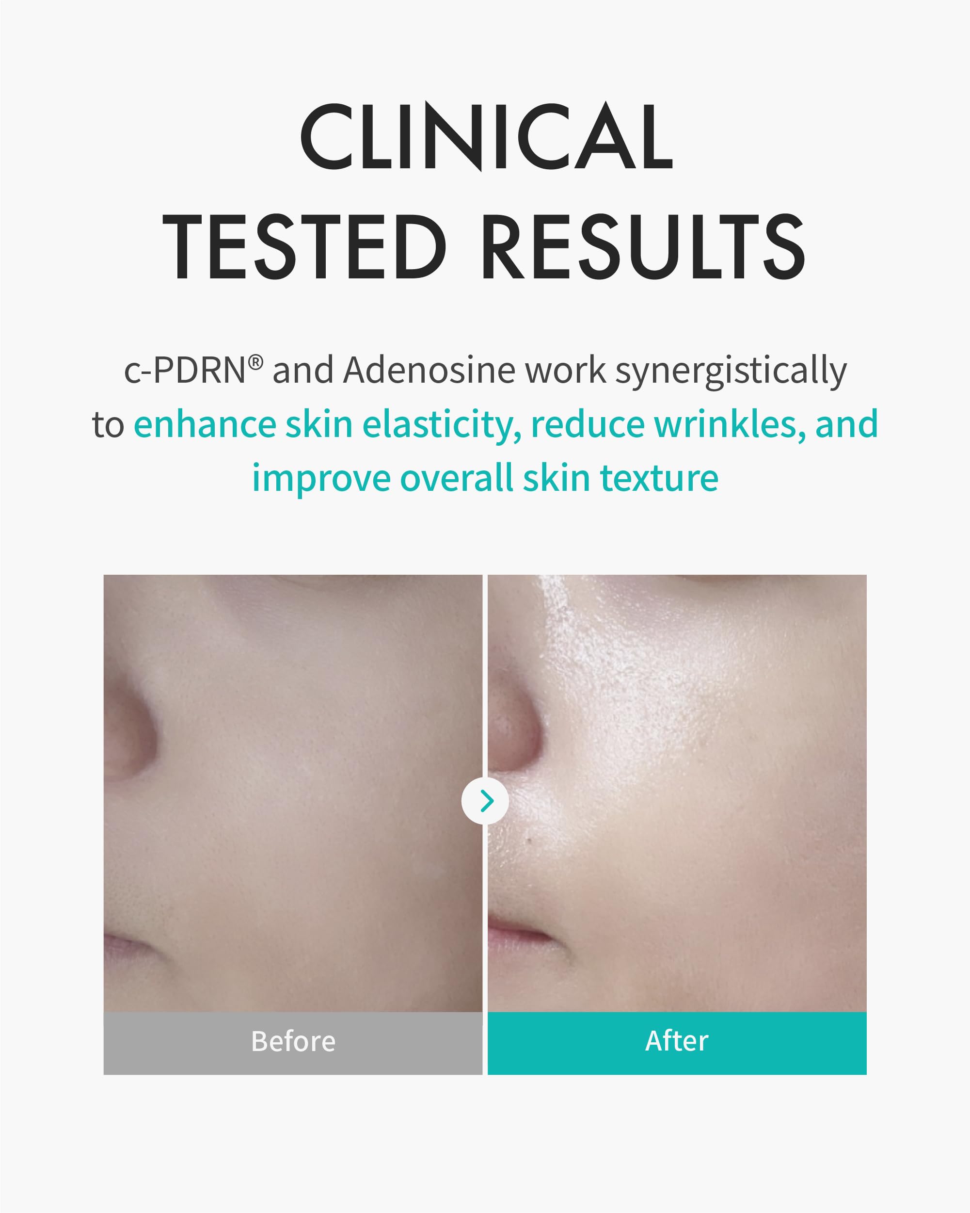 REJURAN® Turnover Mask, c-PDRN® (5ea) – Original Salmon DNA for Firming, Hydration, Repairing & Revitalizing. Achieve Youthful, Radiant Skin. Korean Skincare. Ultra Microfiber Sheet Mask